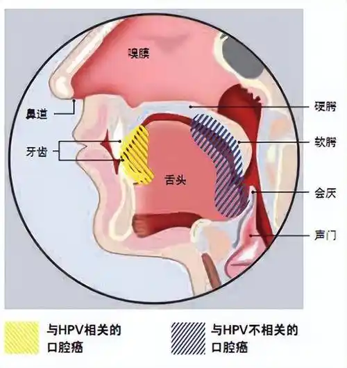 喉癌到来前身体已发出4种警报真正留意到的人却不多