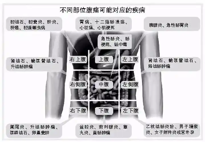肚子疼,到底是哪里出了问题?一张图帮你初步判断,找对科室!