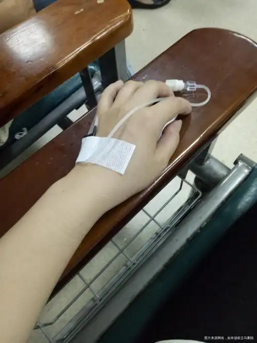 输液打针第二天进行中