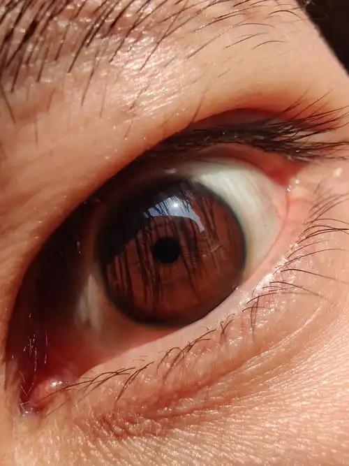 微距下的瞳孔清澈明亮