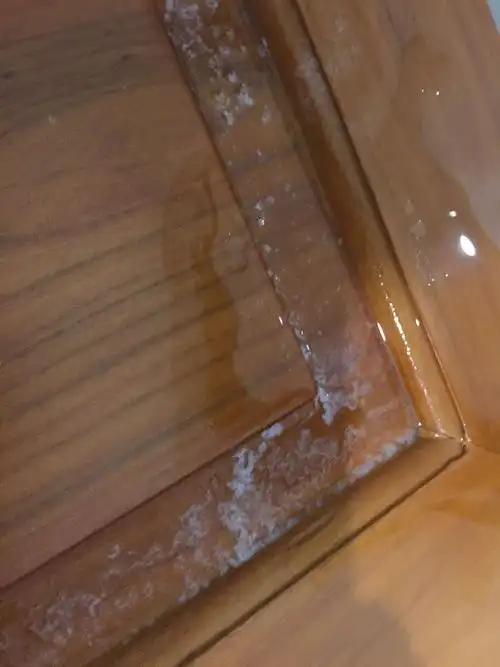 请专业人士和医生看看这是怎么回事,尿液中含白色的东西