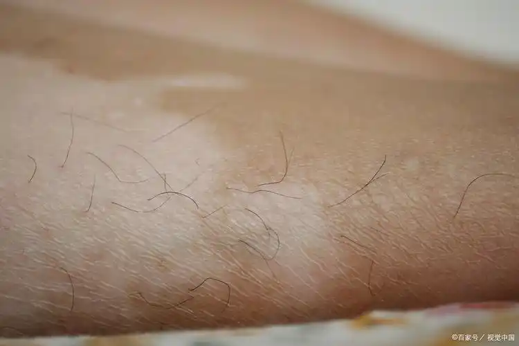 5大元凶被揪出来了!