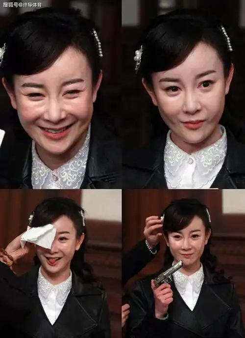 那些整容失败的女星,轻度失败的"高级脸"没了,严重者命都没了