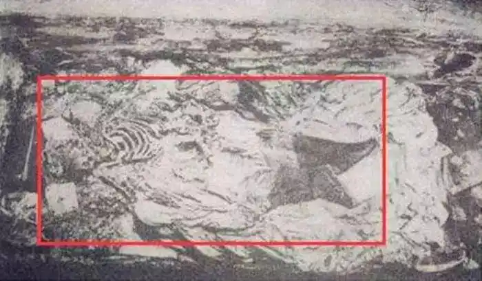 还是将尸骨复原之后右腿明显比左腿短的情形,都可以证明万历皇帝生