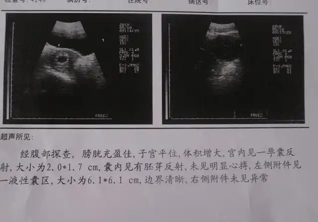 孕期三个月生男孩的征兆总结,看看您有吗