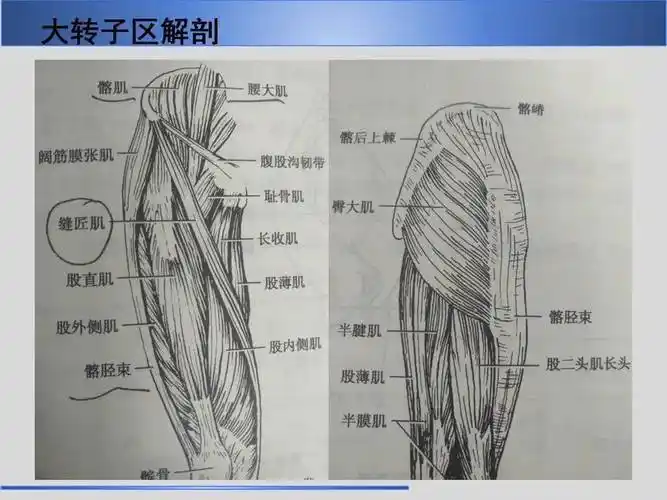 股骨大转子疼痛综合征mr特征