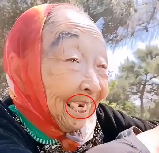 85岁马玉琴和李玉成看海,走不动路让老公背着走,被磕掉一颗牙