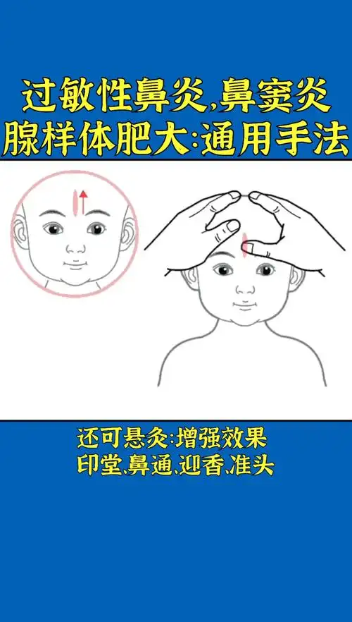 小儿鼻炎腺样体肥大小儿推拿手法