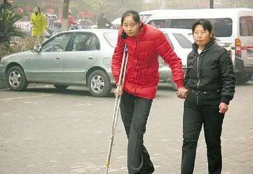 中国女巨人姚德芬,身高2.36,比姚明高,希望可以吃饱饭