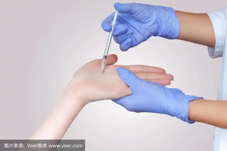 医生在一个女人的手掌上肌肉注射肉毒杆菌毒素
