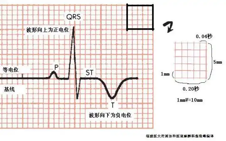 解读临床心电图:形成,诊断及临床意义(上)