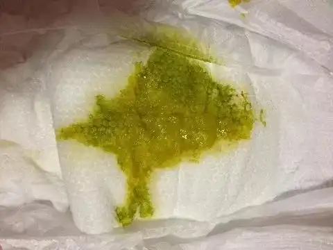 孩子便便发绿,主要出现在两种情况,一种是孩子最近可能在吃补铁的东西