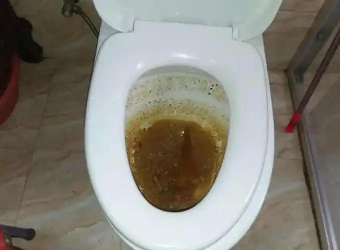 马桶堵了屎和水满满的怎么疏通-全民百科