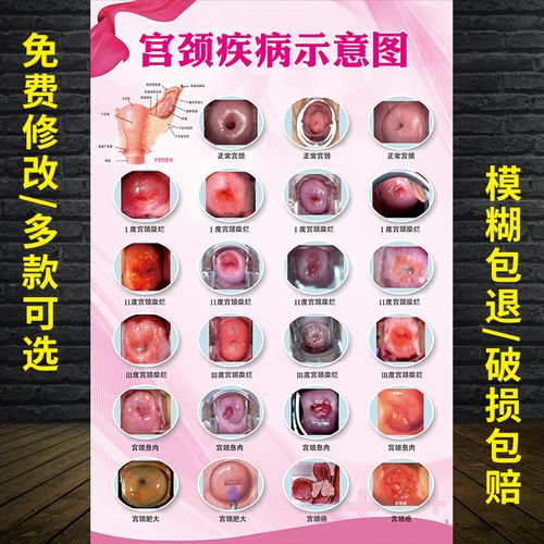 女性生殖系统挂图-特价促销-优惠券领取-价格|多少钱|什么牌子好-35优