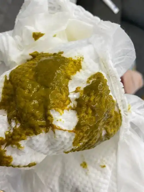 宝宝腹泻老不好 内有大便图 慎入