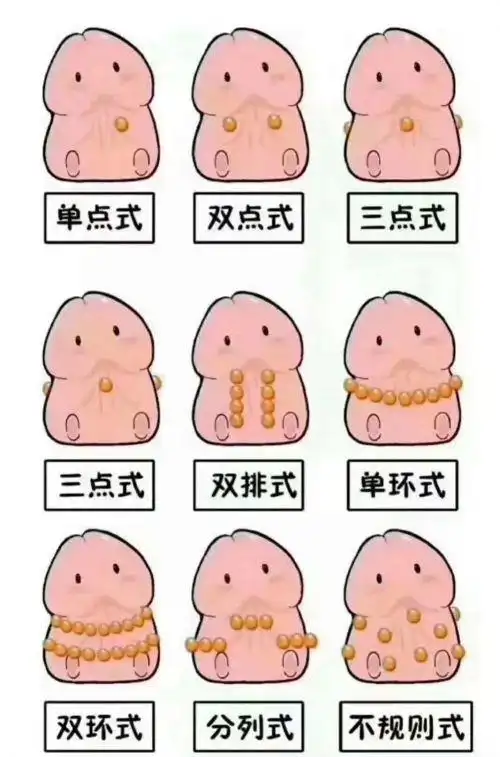 扬州男士增粗入珠效果怎么样 入珠需要注意什么吗