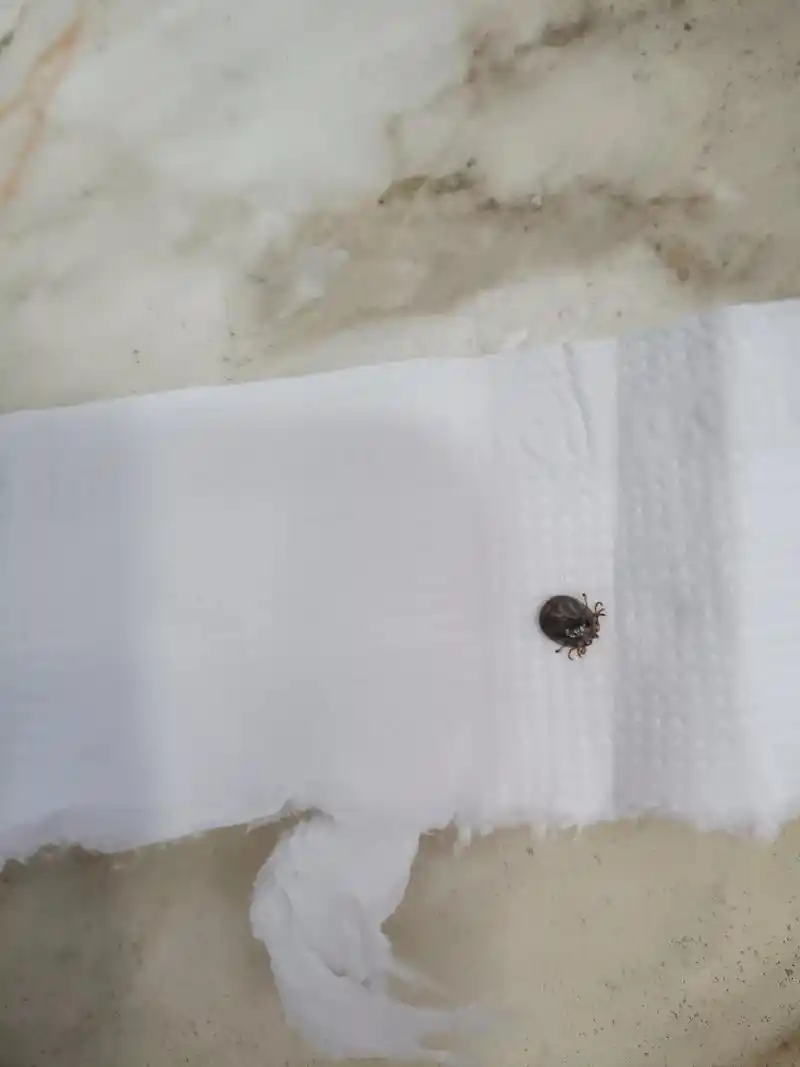 今天友情提示友友们!本人被蜱虫咬钻到肉里面去了 ,本人自己就 - 抖音