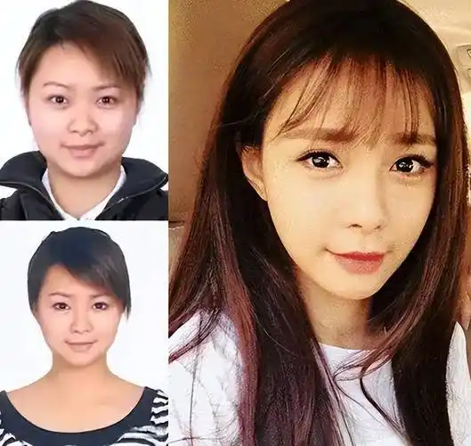 娱乐圈的整容风云:真实与假象的边界_鞠婧祎_杨颖_女明星