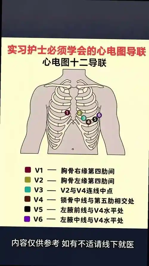 实习护士必须学会的心电图导联