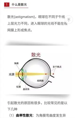 近视 远视 散光行成的真正原因是这样