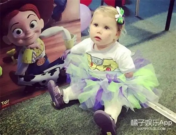 感人1岁小女孩因病失去四肢戴上义肢学走路