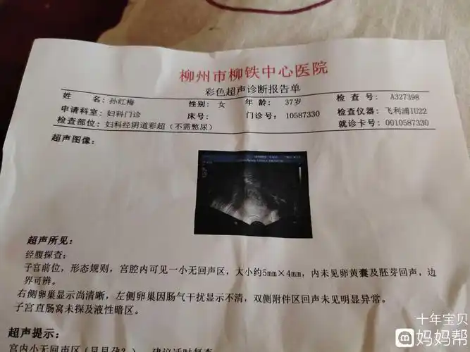 35天,孕囊5*4,天数和大小基本符合