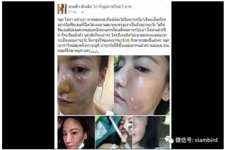 泰国美女打6年美白针彻底毁容!这些失败超恐怖