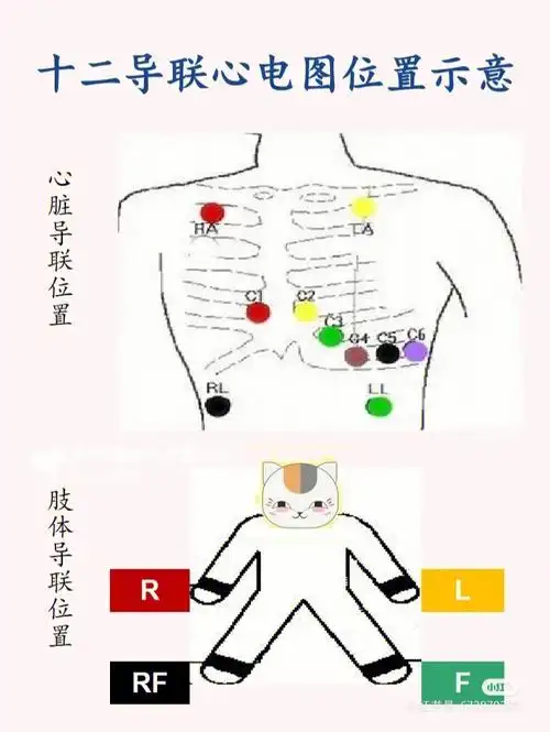 心电图电极的接法