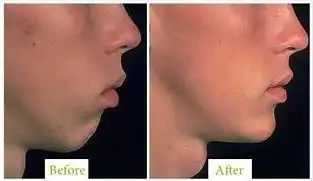 张嘴睡觉会变丑,把多少人忽悠焦虑了