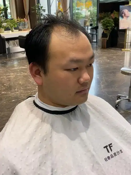 脱发男士发型