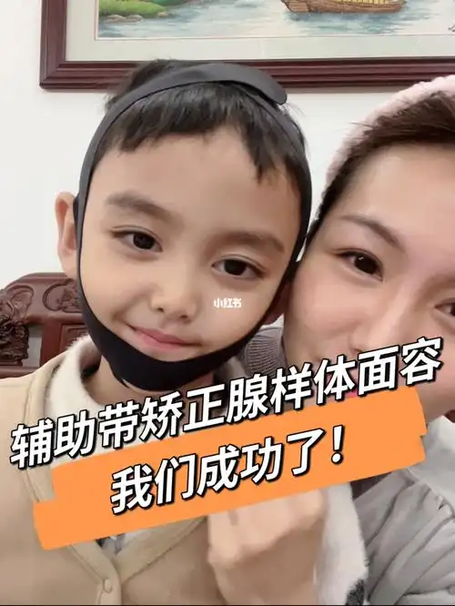 矫正腺样体面容我们推荐它