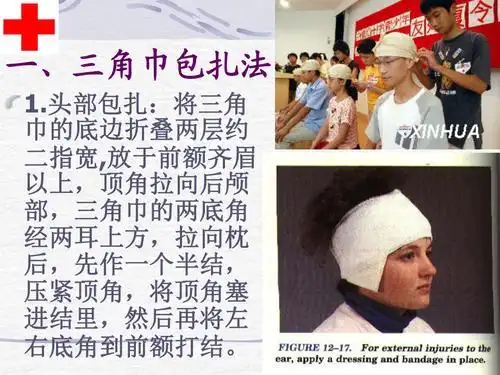 一三角巾包扎法