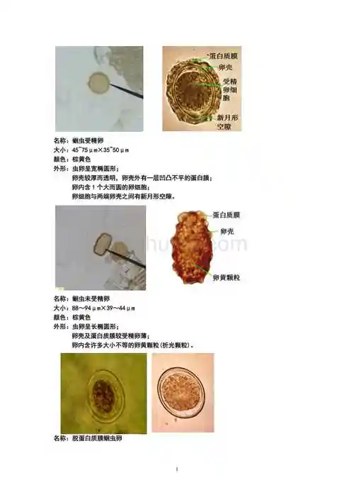 寄生虫虫卵镜下图片汇总