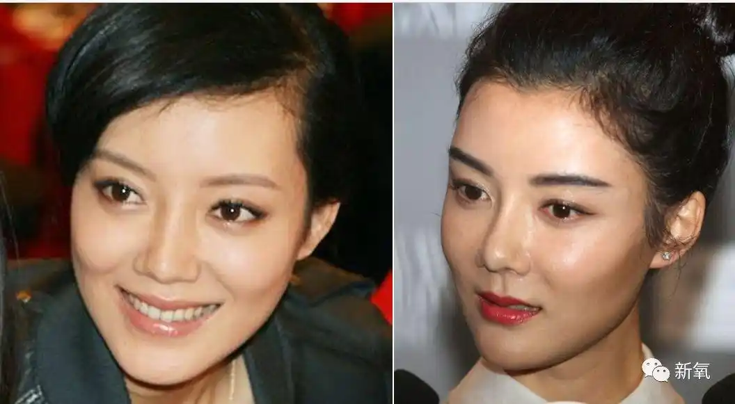 假体|鼻头|车晓_新浪新闻