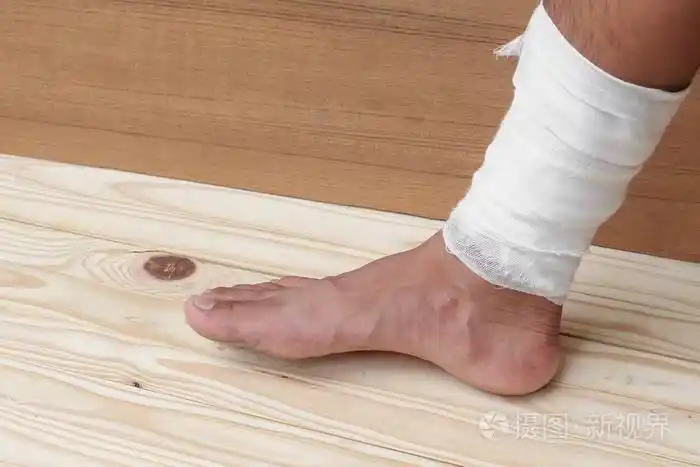 纱布绷带的医师脚踝受伤的治疗情况