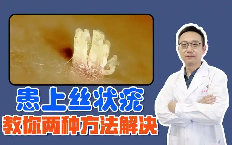 患上丝状疣,教你两种方法,轻松去除不复发