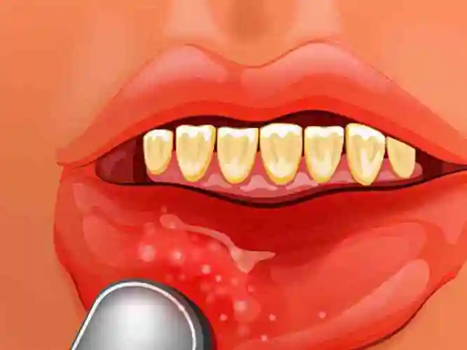 决定临床表现,如下所示:皮肤表现皮肤大多都表现为出现米粒大小的丘疹