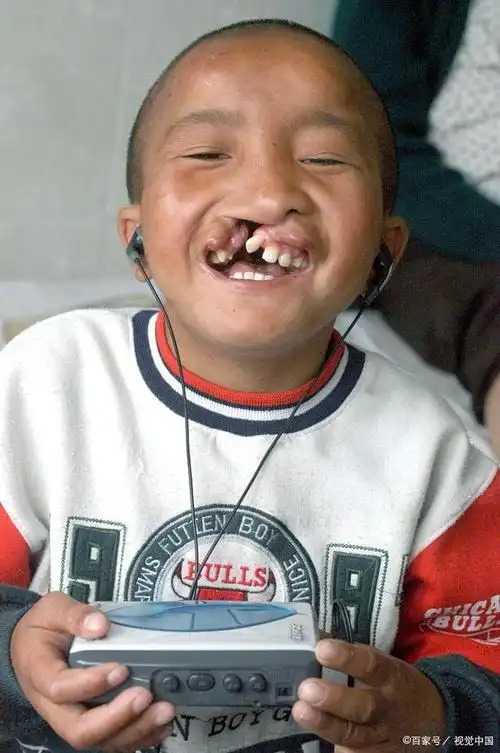 最后,我们来了解 :好高骛远,为自己的天生兔唇争口气,故作高傲且执拗