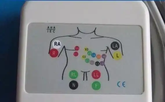 心电监护仪:三导联与五导联有何区别及意义?
