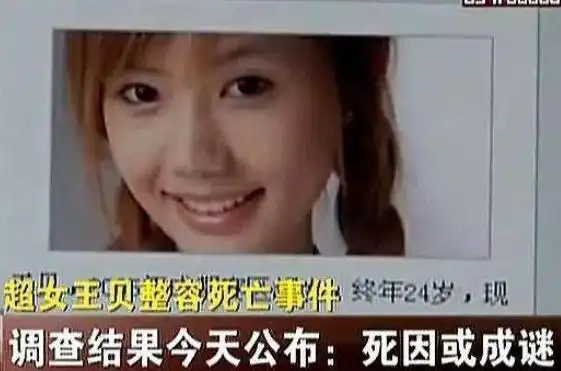 王贝想要漂亮的"瓜子脸",决定做颌面骨整形手术.