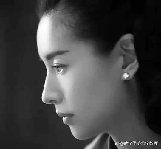 好看的鼻子千千万,但在别人脸上好看的,不一定在你脸上就和谐,所以