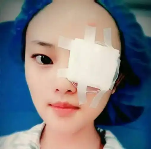 当我睁开眼的第一瞬间,感觉眼前既模糊又清晰,因为有眼药水和眼膏的