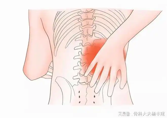 腰疼多休息休息就好了你错了腰肌劳损的三个误区一定要知道