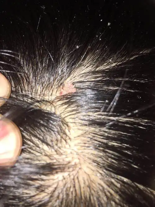 我这头上长的什么东西