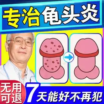 龟头炎喷雾剂包皮炎专用红点念珠菌降低头敏感度药