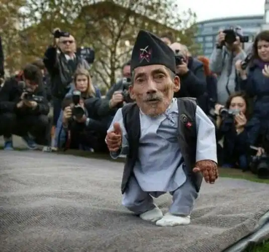 世界上最小的5位袖珍人,马加尔身高仅50厘米