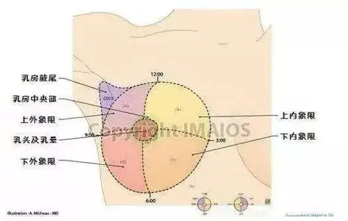 有这5种症状出现警惕乳腺癌
