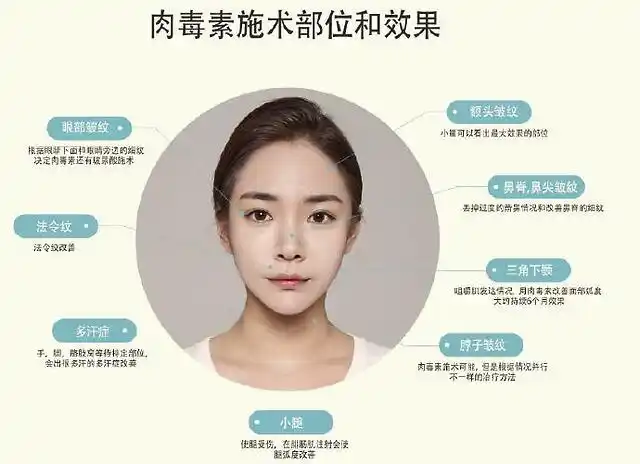 不同品牌肉毒素效果有差吗多次注射会产生抗体甚至沉积中毒吗