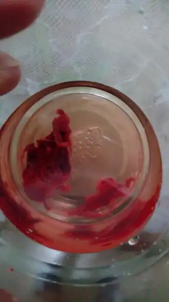 怀孕6周左右 做的药流,请帮看看这个是不是孕囊,或者胚胎的东西