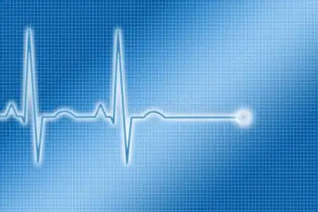 蓝色心电图描记照片